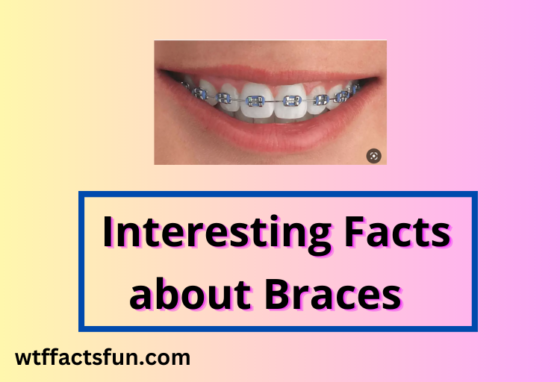 Facts about Braces