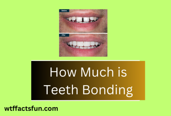 How Much is Teeth Bonding